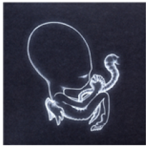 Vinyle Sigur Ros - Agaetis Byrjun (Lp+Cd)