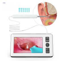 Digital Otoscope with 4.3 inch Screen 1080p HD Smart Visual Ear Camera Ear Wax Removal Tool Camera Support Photo Video Recording