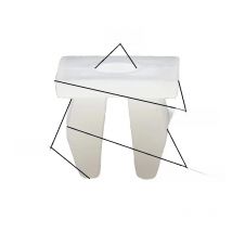 Square Head nut grommet molding clips plastic white retainer fixed car trim accessories mounting snaps