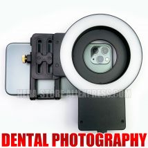 mórico della lampada di rifornimento orale della luce della fotografia dentale intraorale per il