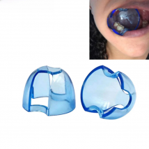 Dental Intraoral Cheek Retractor Lip Mouth Opener Tooth Whitening For Anterior Posterior Teeth