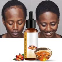 Lewedo Naturals Batana Oil Fast Hair Growth for Men Women Pure Batana Oil Nourish Shiny Hair Healthy Hair Care Anti Hair Loss