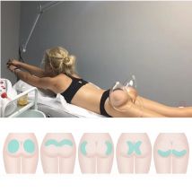 Spedizione veloce corpo modellante macchina per terapia del vuoto linfodrenaggio corpo dimagrante ingrandimento del seno macchina ventose fianchi ventose