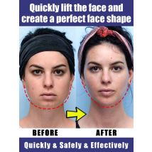 Doppel kinn entfernen