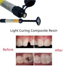 Materiale di riempimento adesivo universale in resina composita fotopolimerizzante dentale A1 A2 A3 2,5 g