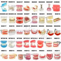 Wiele rodzajów modeli zębów Modely do nauczania stomatologii Studium ortodontyczne Wyjmowane modele implantów zębów Materiał dentystyczny
