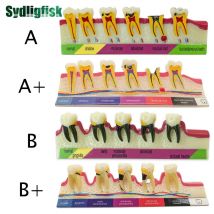 Dental Model Teeth Periodontal Disease Model Assort Demo Caries Model Dentist Teaching Training Doctor-patient Communication