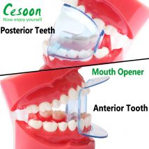 2Pcs Dental Lip Retractor Zahn Dilatator Opener Anterior Hinten Zahn Wange Autoklav Doppel Lip Retractor Mund Opener Werkzeuge