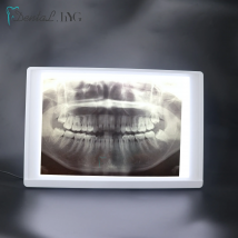 Dental Geräte X-Ray Film Illuminator Licht Box X-ray Viewer Licht Panel Bildschirm Zahnarzt Oral hygiene panorama viewbox Werkzeuge