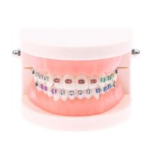 Azdent Dental Modell Ausbildung Typodont Zähne Modell Für Zahntechniker Praxis Lehre Zahnfleisch Zähne Kiefer Modell Harz Labor Werkzeuge