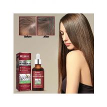 OUHOE Hair Restoration Serum Nourishing Scalp Hair Growing Firming Root Repair Dry Damaged Moisturizing Hair Regrowth Oil
