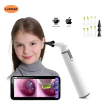 Strumento per la rimozione del cerume Smart WiFi Luce visibile Ear Scoop Home Must 3.9mm 720P per telefono Android mobile
