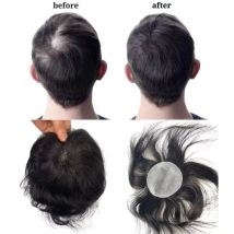 Thin Skin PU Bald Spot European Hair Patches Toupee for Men Dia. 8cm Hair Piece Glue On Hair Replacement System