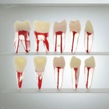 Set di 10 denti per addestramento endodontico dentale RCT con blocchi in resina per cavità della polpa per kit modello di pratica per studio endodonico del canale radicolare
