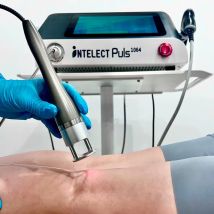 Medizinisches Laser-Stoßwellen-Fysiotherapiegerät 10 Bar Radial ESWT für akute und chronische Behandlung