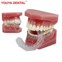 Kieferorthopädisches Modell Zähne Klarer Aligner Unsichtbares zahnärztliches kieferorthopädisches Zahnmodell mit Zahnspangen zum Lernen der Lehrdemonstration