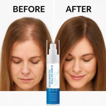 Siero roll on per la crescita dei capelli al rosmarino da 25 ml 3% rosmarino 3% Redensyl 2% Anagain riduce la caduta dei capelli Siero per capelli per donne e uomini