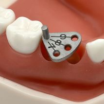 Dental Implantat Parallel Pin Gauge Edelstahl Medizinische Lacator Dental Implantat Locatring Guide Ortung Lineal