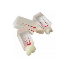 Dental Endodontic Root Canal Block Model Dentistry Education Teaching Resin Endo Training RCT Practice Pulp Cavity Tooth Models
