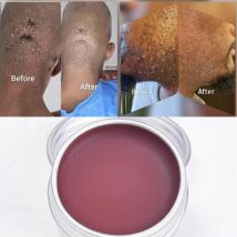 Natürliche Bump Stopper Creme & Seife | Rasiermesser Bumps Stopper