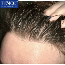 Protesi per capelli maschili Linea sottile invisibile con pelle ultra sottile 0,03 mm Parrucchino Parrucca da uomo Sistema di sostituzione dei capelli umani al 100% Parrucca maschile