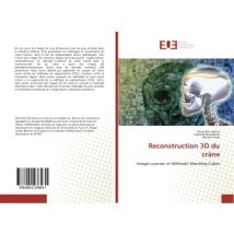 Reconstruction 3d Du Crâne