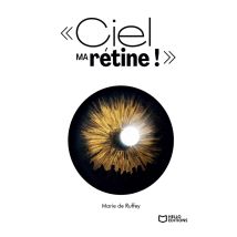 Ciel Ma Rétine ! : Chroniques D'Une Cécité Annoncée