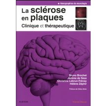 La Sclérose En Plaques - Clinique Et Thérapeutique