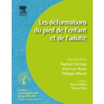 Les Déformations Du Pied De L?enfant Et De L?adulte