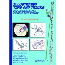 Illustrated Tips & Tricks For Arthroscopic Rotator Cuff Repair