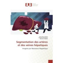 Segmentation Des Artères Et Des Veines Hépatiques