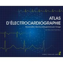 Atlas D'Électrocardiographie : Reconnaître L'Électrocardiogramme Par L'Image