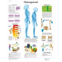 Lavagna per sensibilizzazione osteoporosi 50x67 cm - Carta 200 g - BORBONE
