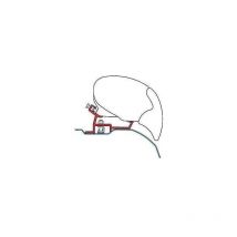 Adaptateur store FIAMMA F65S pour Ducato-Jumper Boxer High Roof après Juin 2006