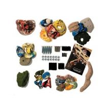 Metolius Mega Pack 30 - Klettergriffe