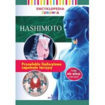Hashimoto. Encyklopedia zdrowia