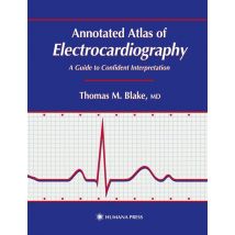 Annotated Atlas of Electrocardiography