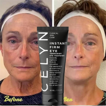 Crème pour les yeux ferme et instantanée, 30ml, réduit les ridules et les cernes autour des yeux, lifte la peau, élimine les poches, resserre les yeux