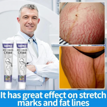 QLZHANFU Stretch Marks Permanent Removal Cream Eliminate Body Belly Stretch Marks Swelling Marks Remove Skin Cracks