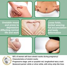 Jayswing repair spray postpartum fade pregnancy wrinkles body skin care fluid