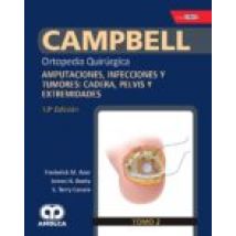 Campbell Ortopedia Quirurgica (tomo 2): Amputaciones Infecciones Y Tum