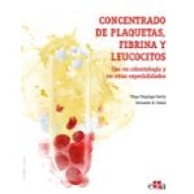 Concentrado De Plaquetas Fibrina Y Leucocitos. Uso En Odontologia Y En