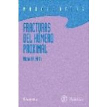 Fracturas Del Humero Proximal