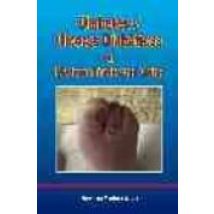 Diabetes Y Ulceras Diabeticas