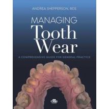 Managing tooth Wear. A comprehensive guide for general practice